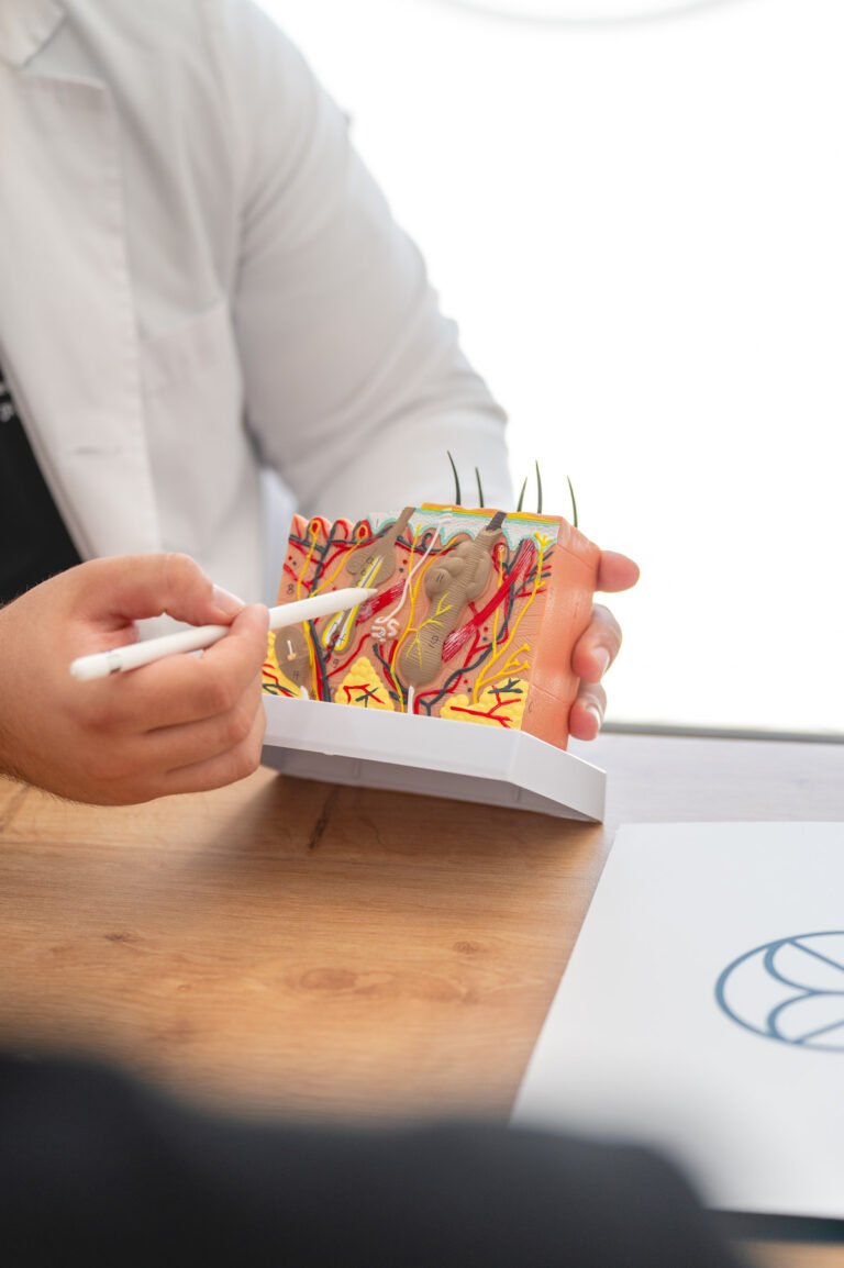 Maqueta fibras capilares KBO Capilar Clínica de Medicina y Cirugía Capilar en Almería